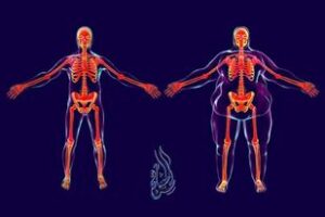 السمنة أسبابها وطرق الوقاية