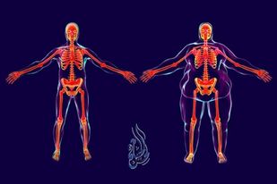 السمنة أسبابها وطرق الوقاية